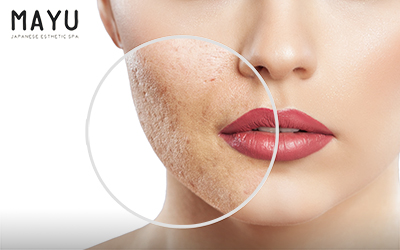 Mayu Spa Nhật Bản Khuyến Mãi