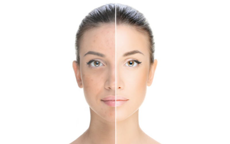 Phương pháp chăm sóc da Skin Renewal