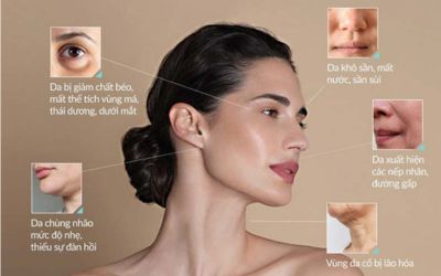Tiêm BAP Profhilo giúp trẻ hóa làn da và cải thiện các nếp nhăn