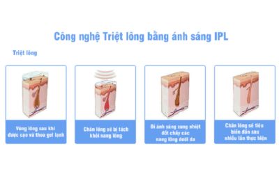 triet-long-nach-nhat-ban-6