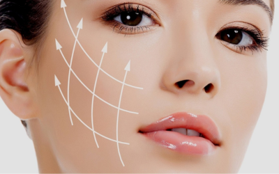 rf-facial-2