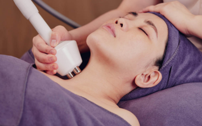 rf-facial-3