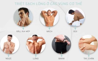 Triệt lông toàn thân quận 2_3