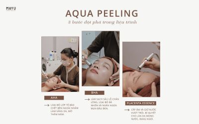 aqua peel là gì_5