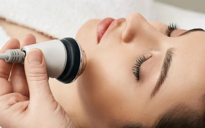 sở hữu mặt Vline không cần dao kéo_5
