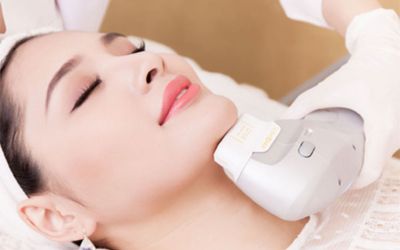 sở hữu mặt Vline không cần dao kéo_6