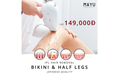 triệt lông ipl và shr_1