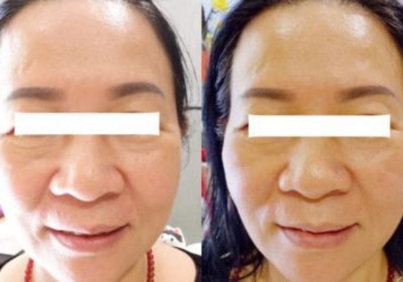 Mayu cam kết báo giá minh bạch - không phát sinh phụ phí, mang lại sự yên tâm tuyệt đối cho khách hàng.