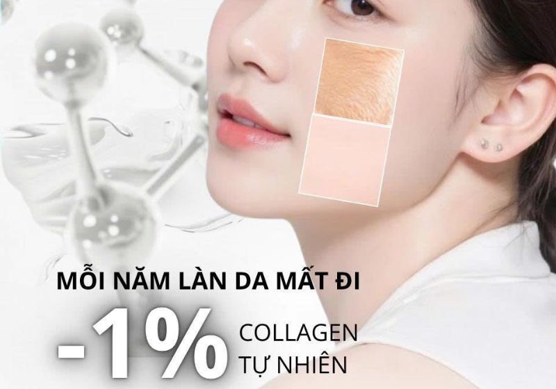 cinderella-teoxane-1