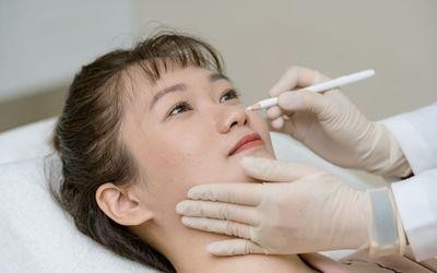 After about 1–2 weeks, the skin appears noticeably smoother, plumper, and more radiant.