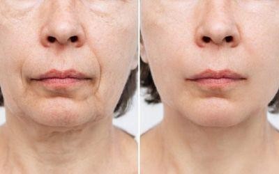 If you are looking for a place that focuses on gentle treatments, transparency, and no pressure to purchase additional services, Mayu Spa is definitely worth considering.