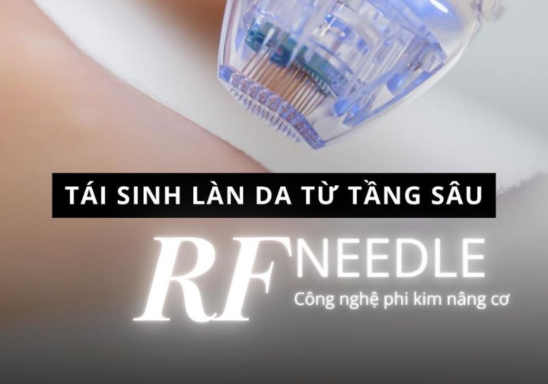 RF utilizes thermal energy to help the skin become smooth and tighten pores