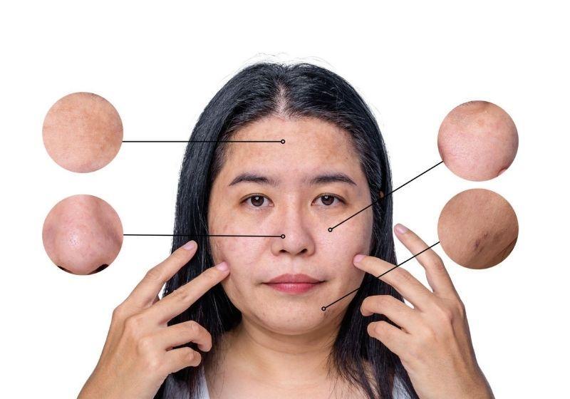 Dù là da khô, da nhạy cảm hay bắt đầu xuất hiện dấu hiệu lão hóa, điều quan trọng nhất vẫn là lựa chọn phương pháp phù hợp