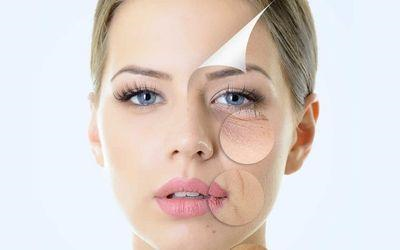 Tiêm Profhilo phù hợp với làn da bắt đầu giảm độ ẩm, đàn hồi và xuất hiện những dấu hiệu lão hóa sớm